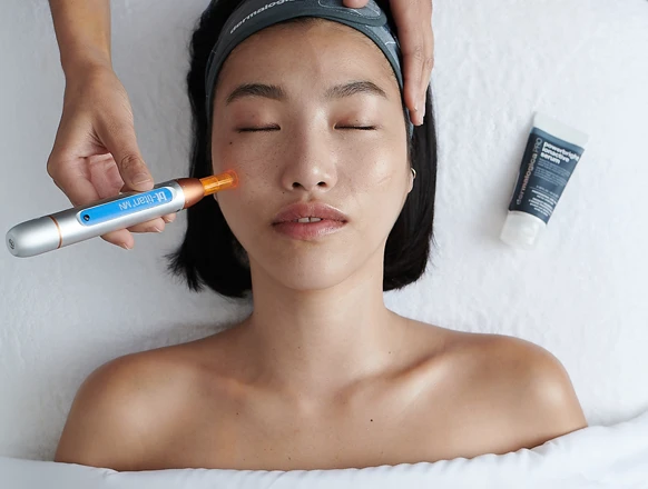 Microneedling
