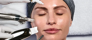 Microneedling