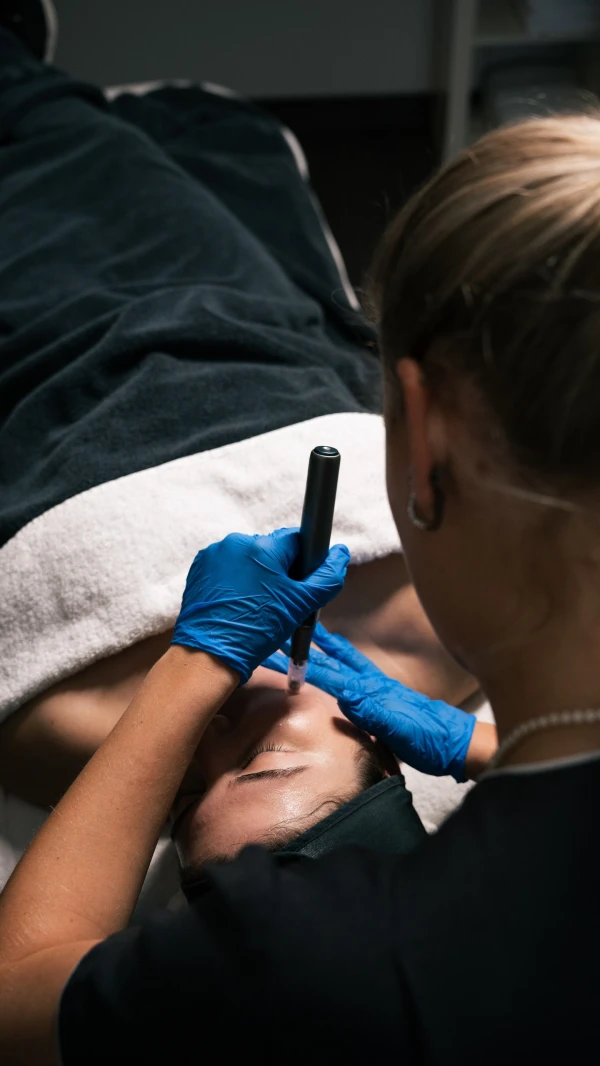 microneedling Leiden
